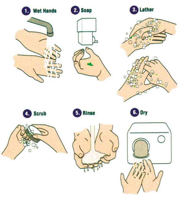 Title: Hand washing instructions - Description: This easy-to-understand diagram shows 6 hand washing procedures:  1) Wet Hands  2) Soap  3) Lather  4) Scrub  5) Rinse  6) Dry